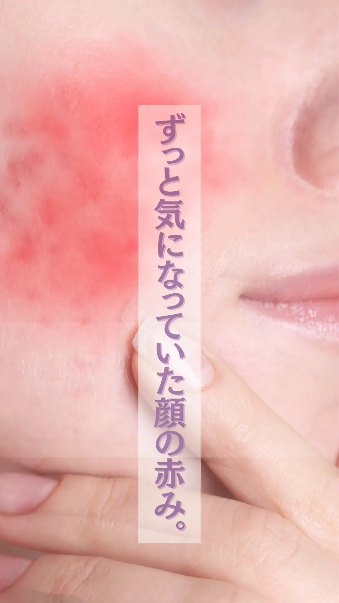 お顔の赤みの原因、見つけました。